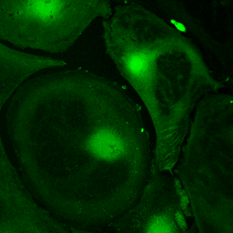 gfp-green-fluorescent-protein